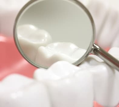 Closeup of teeth in dental mirror