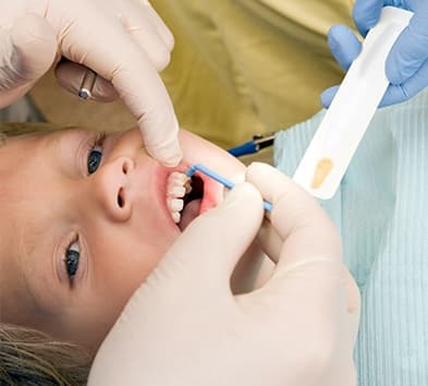 Child receiving fluoride treatment