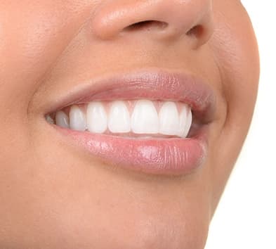 Closeup of smile with flawless teeth and gums