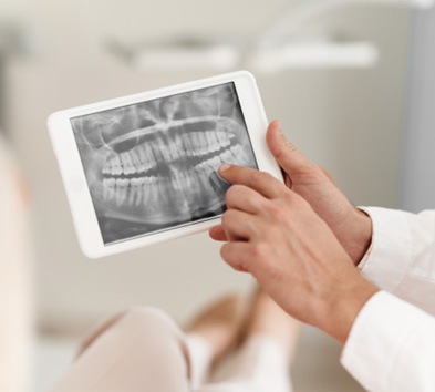 implant dentist in Alexandria pointing to a patient’s X-rays  