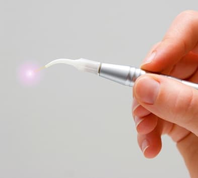 Hand holding a soft tissue laser wand