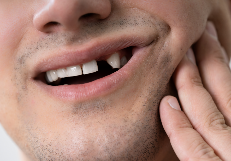 Close up of man missing a tooth